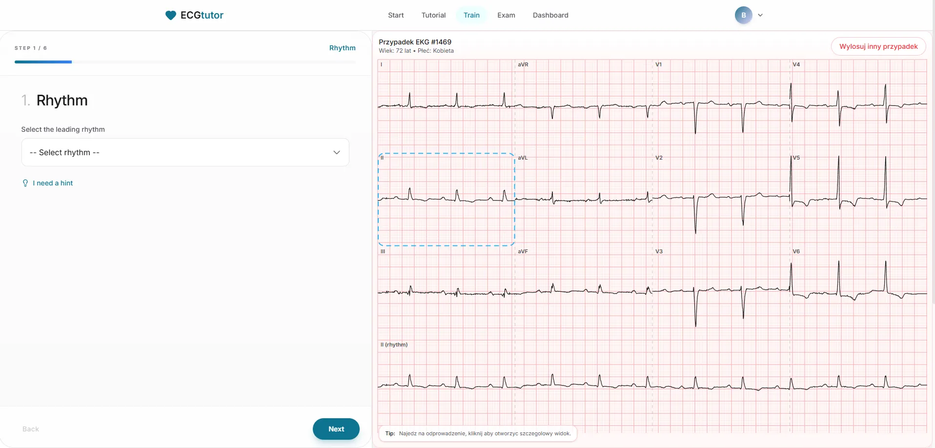 EKG Tutor - AI Diagnostic Guidance