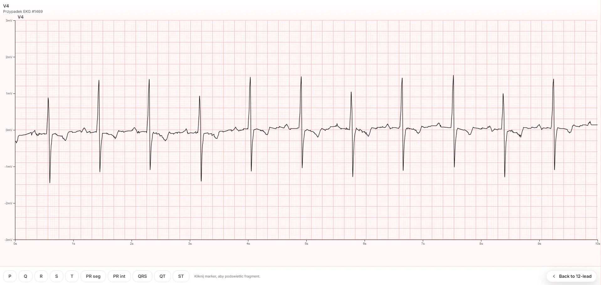 EKG Tutor - Progress Tracking